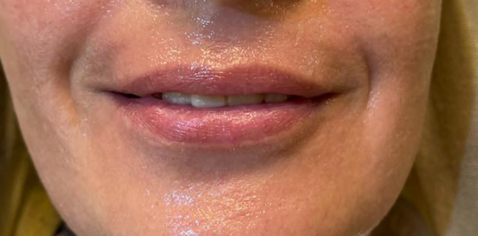 Before image