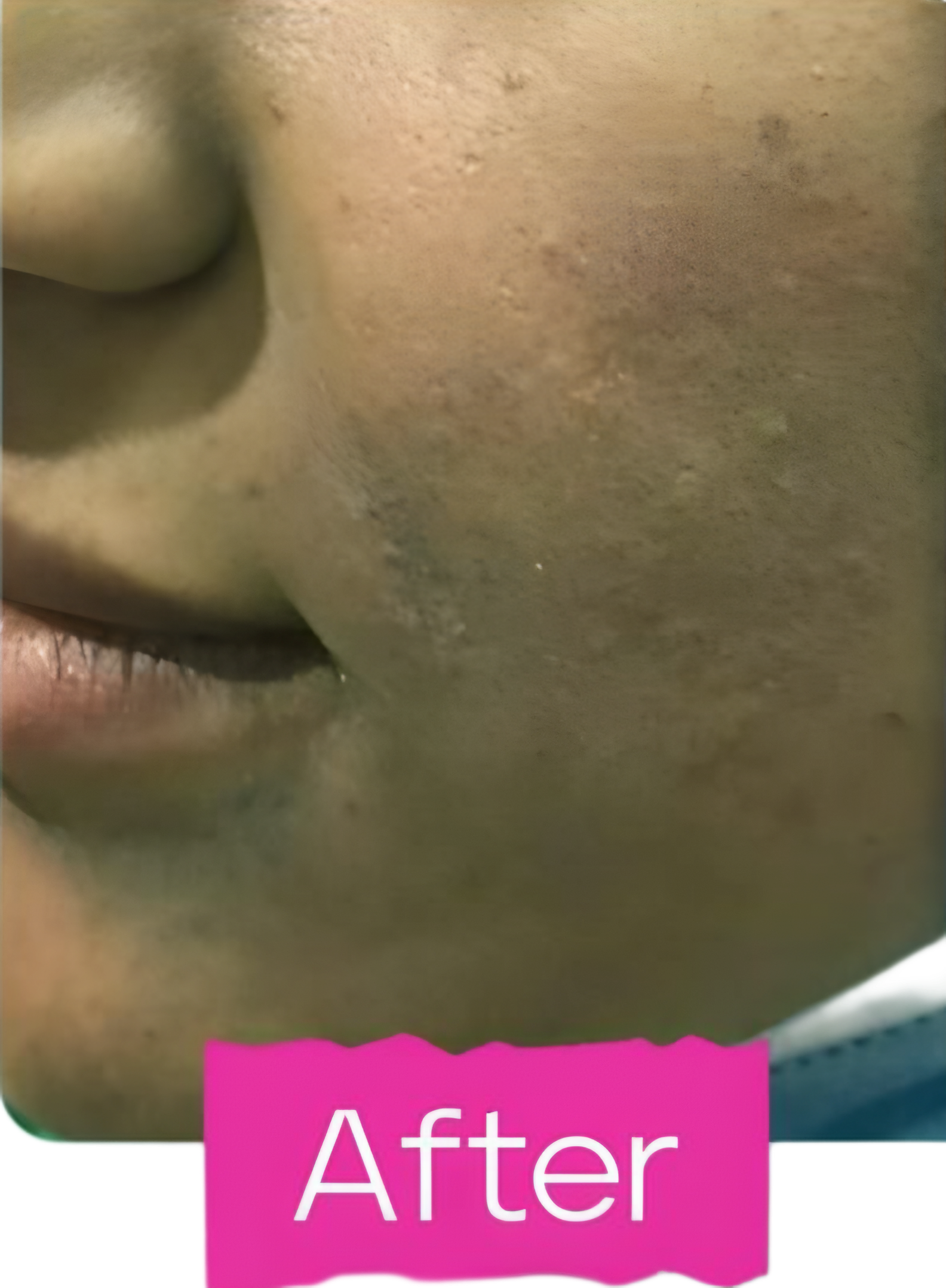 After image