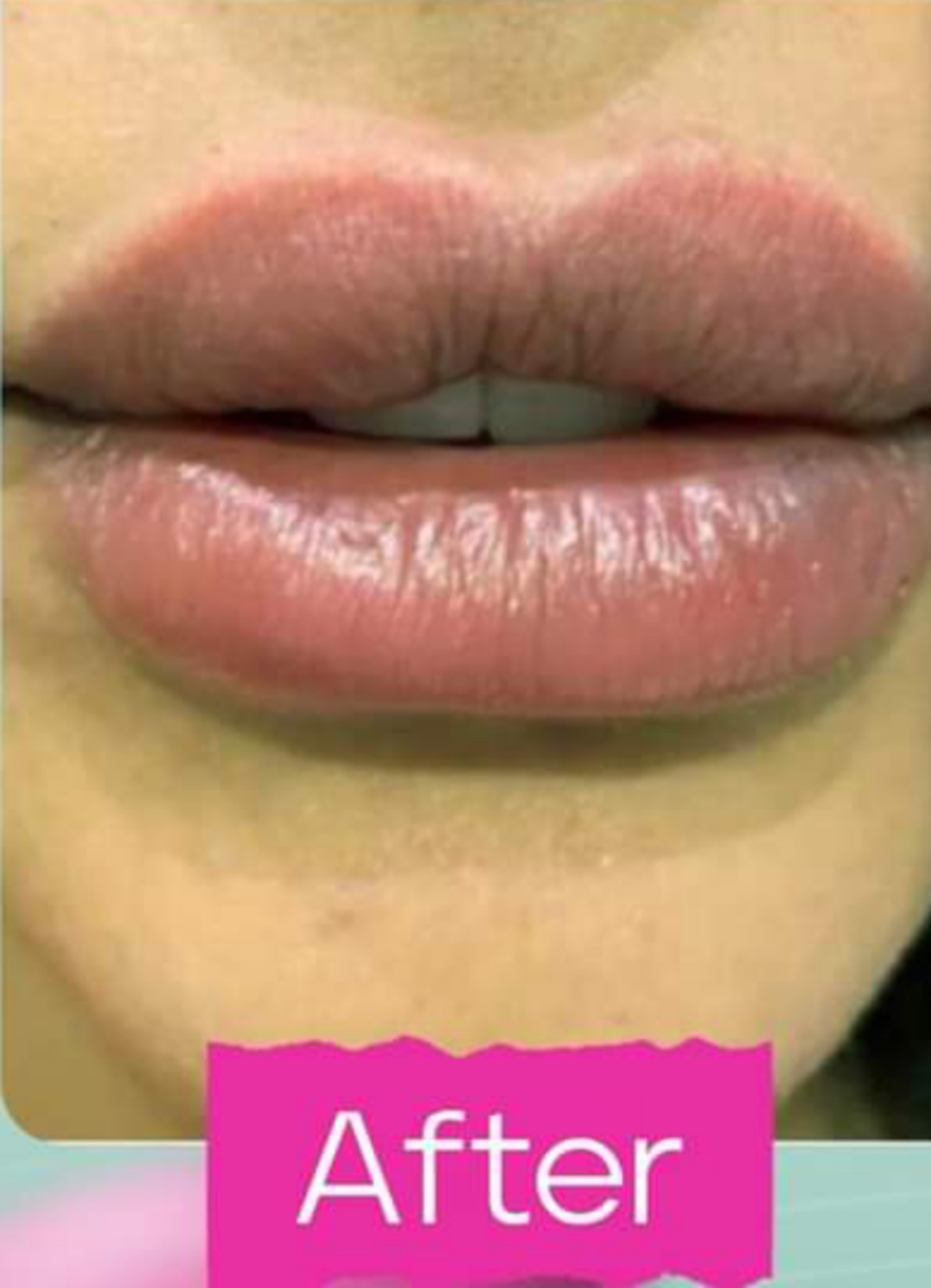 After image