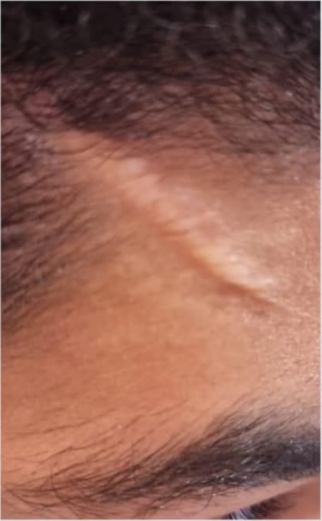 Before image