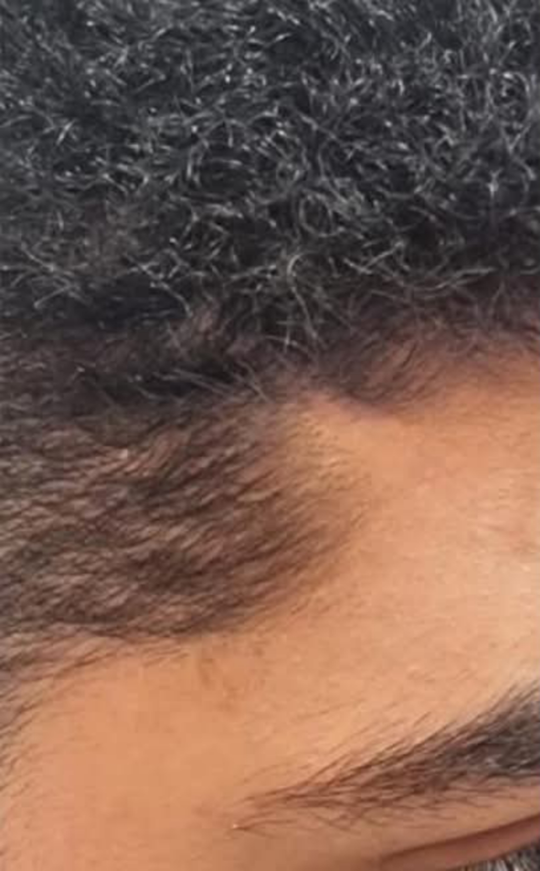 After image